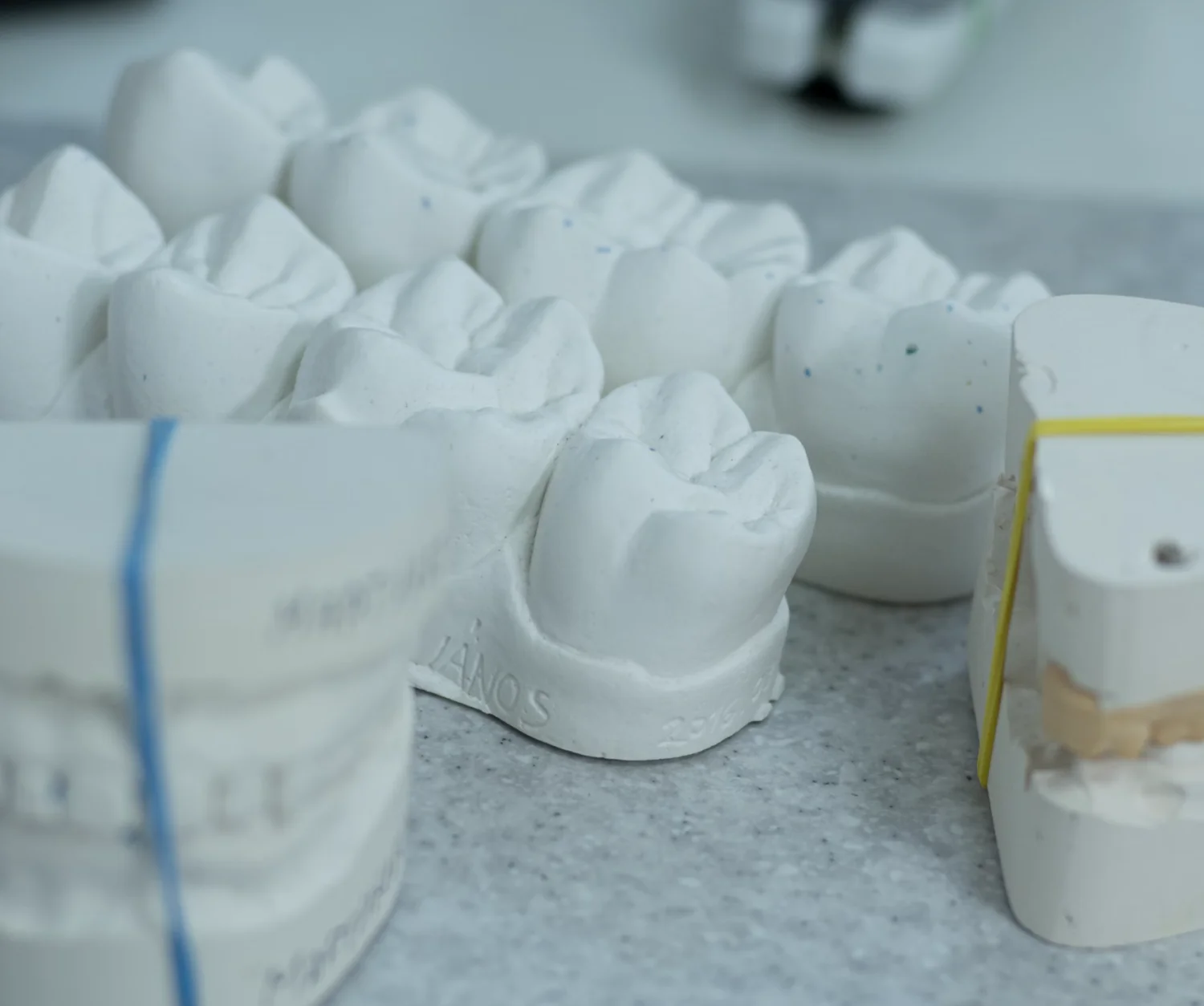 What is the most natural tooth replacement? -  Dentally