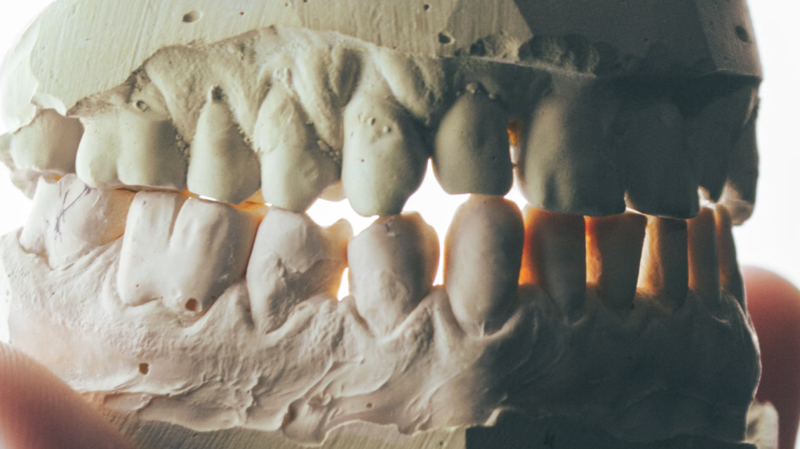 How to Repair Broken Teeth Comprehensive Treatment Options