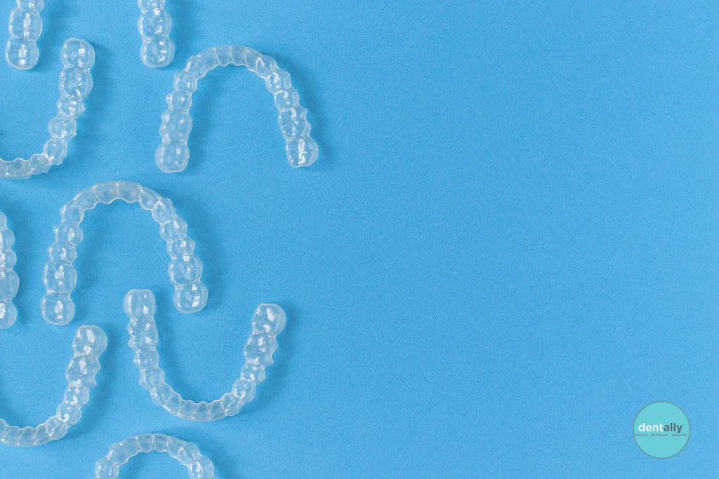 😁 Dent Ally Aligners vs Invisalign: Which Should You Choose? -  Dentally