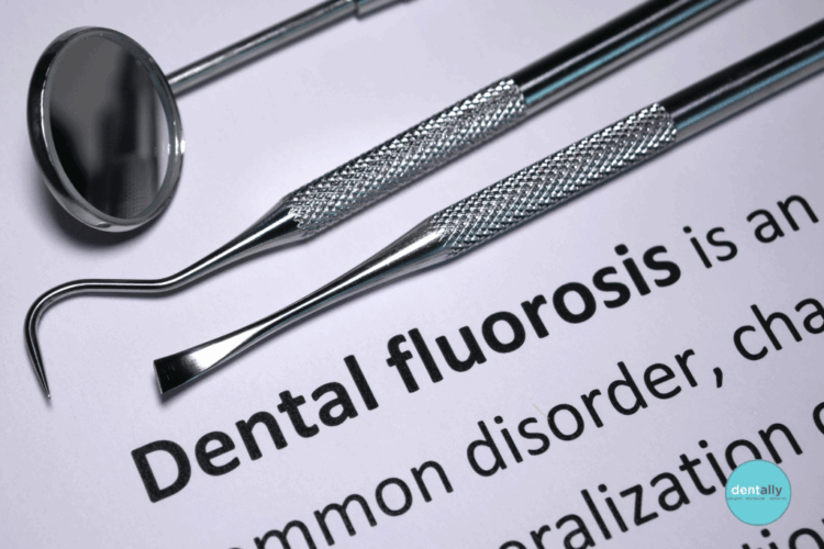 How to Treat Fluorosis Teeth