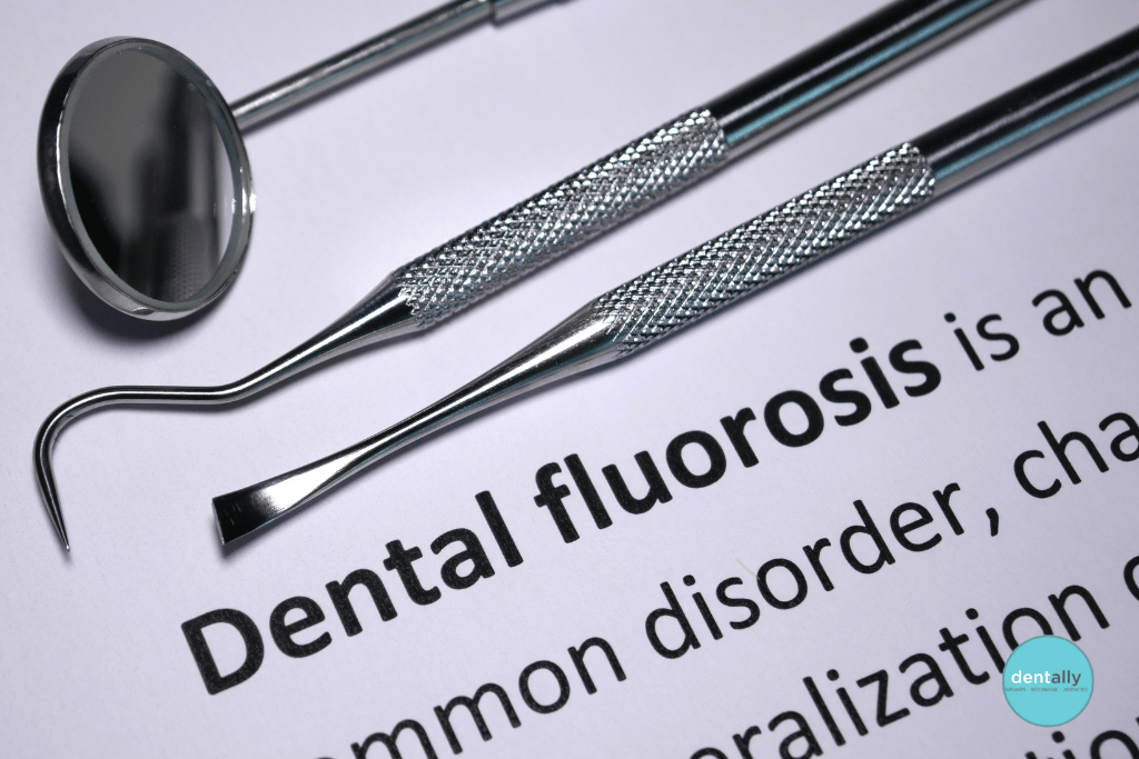 How to Treat Fluorosis Teeth