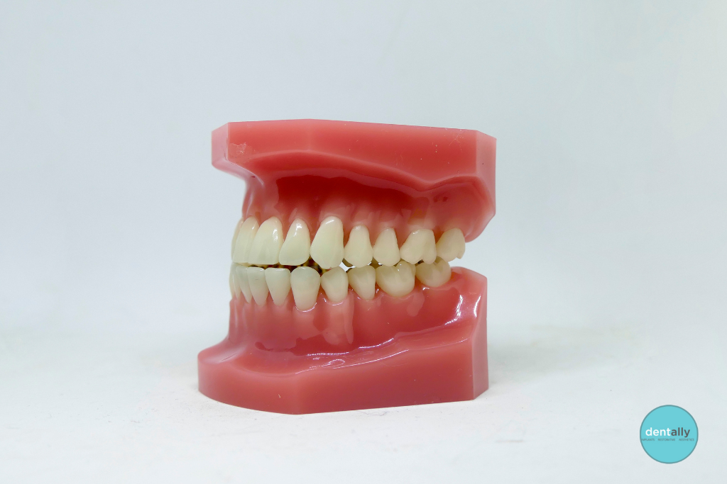 Photos of Abscess on Gums