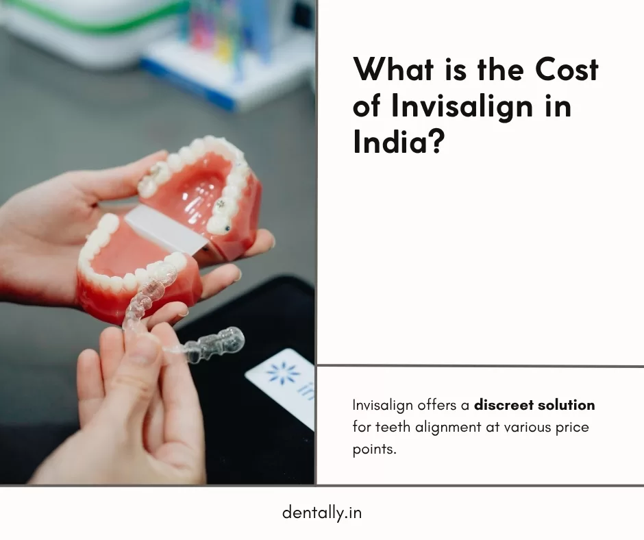 What is the Cost of Invisalign in India