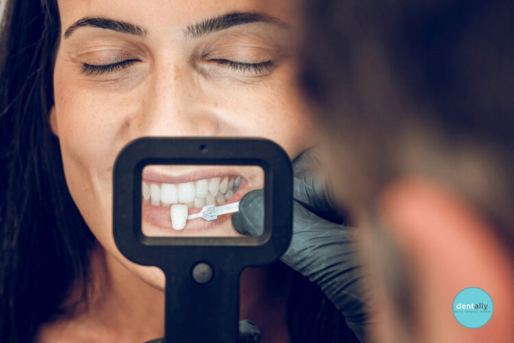 What-is-the-Cost-of-Veneers-for-Two-Front-Teeth-in-India